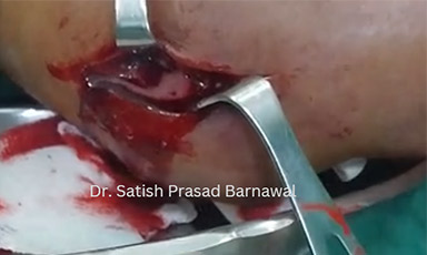 Assessment in Operation Theatre