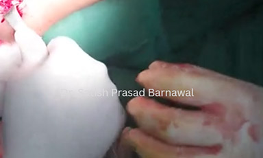 Assessment in Operation Theatre