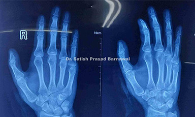 Case 5: Laceration Injury Hand
