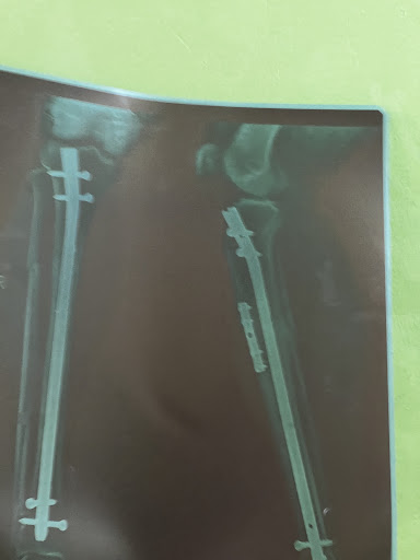 Photo from customer review