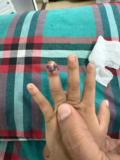 Photo from customer review